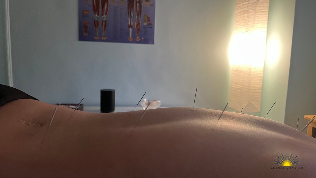 Our main goal for people is to allow them to get back to doing the things that they love as quickly as possible without pain. ⁠
⁠
We also treat many physical symptoms of stress and anxiety which arise from the way our nervous system is affected by st
